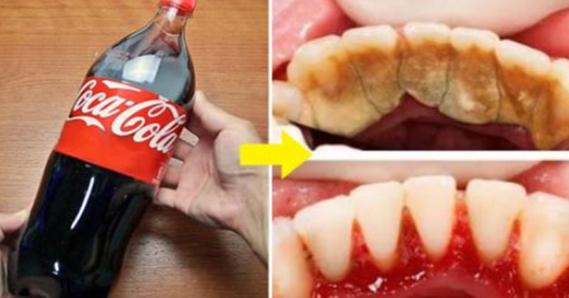 可口可樂這樣用，牙垢自動脫落，5個可口可樂的實用生活技巧，學到就賺到了